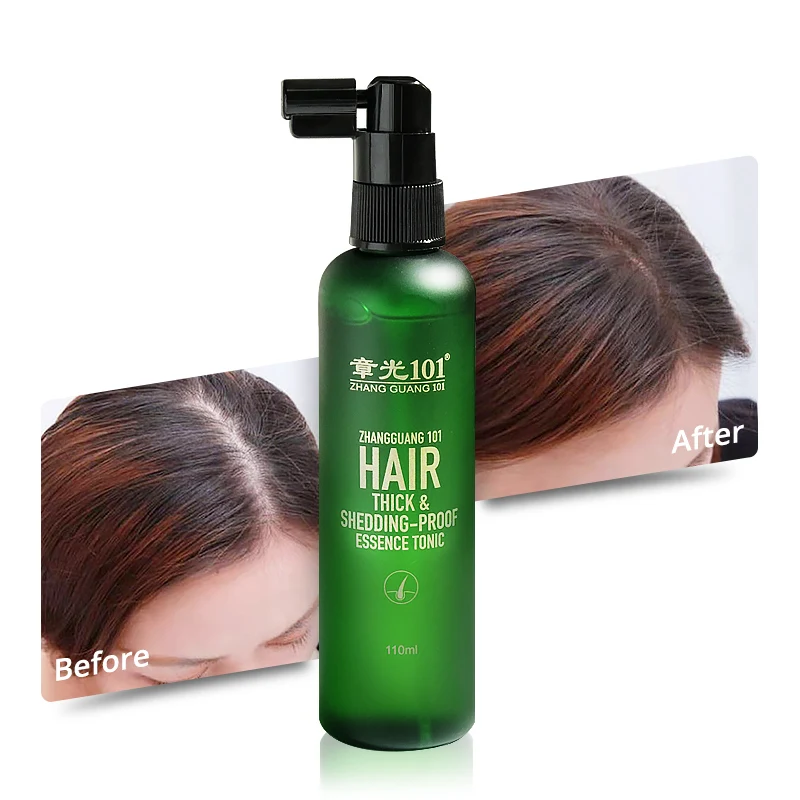 Private Label Castor Oil Extracts Hair Care Hair Growth Serum Spray