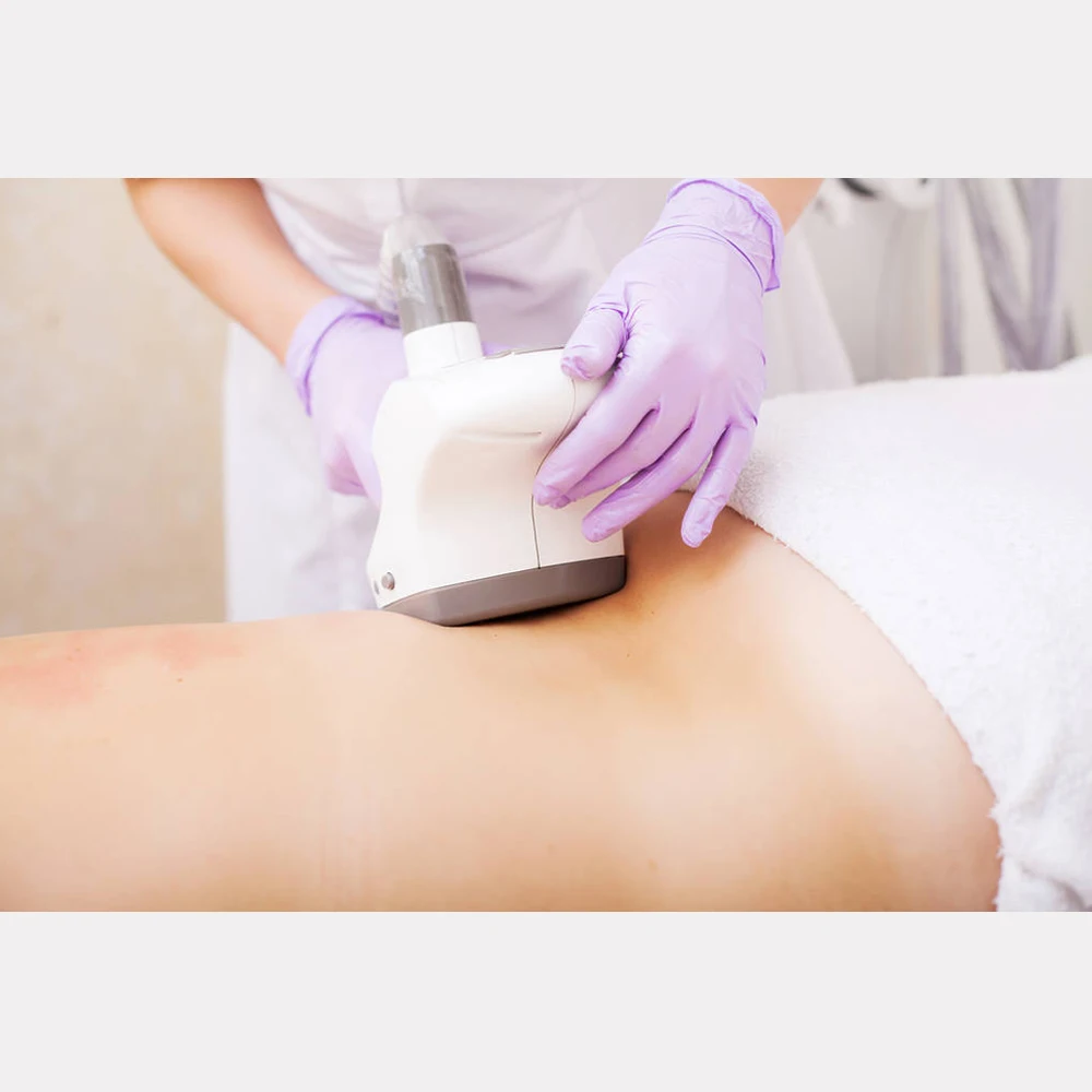 Cavitation Vacuum Laser Bipolar RF Roller Massage Lymphatic Drainage Pressotherapy Slimming Machine Body Sculpting