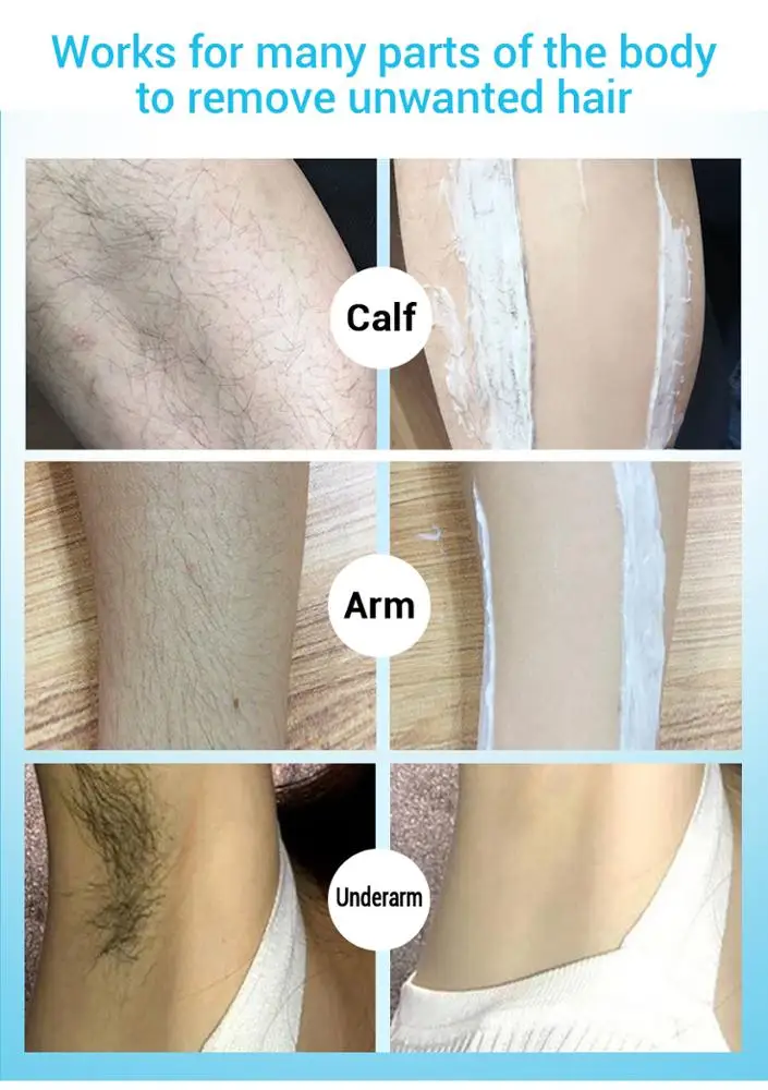 
LANBENA Hair Removal Cream Painless Removal Depilation Calming Balm Gentle Effective Epilator Nourishing Repairing Body Care 80g 