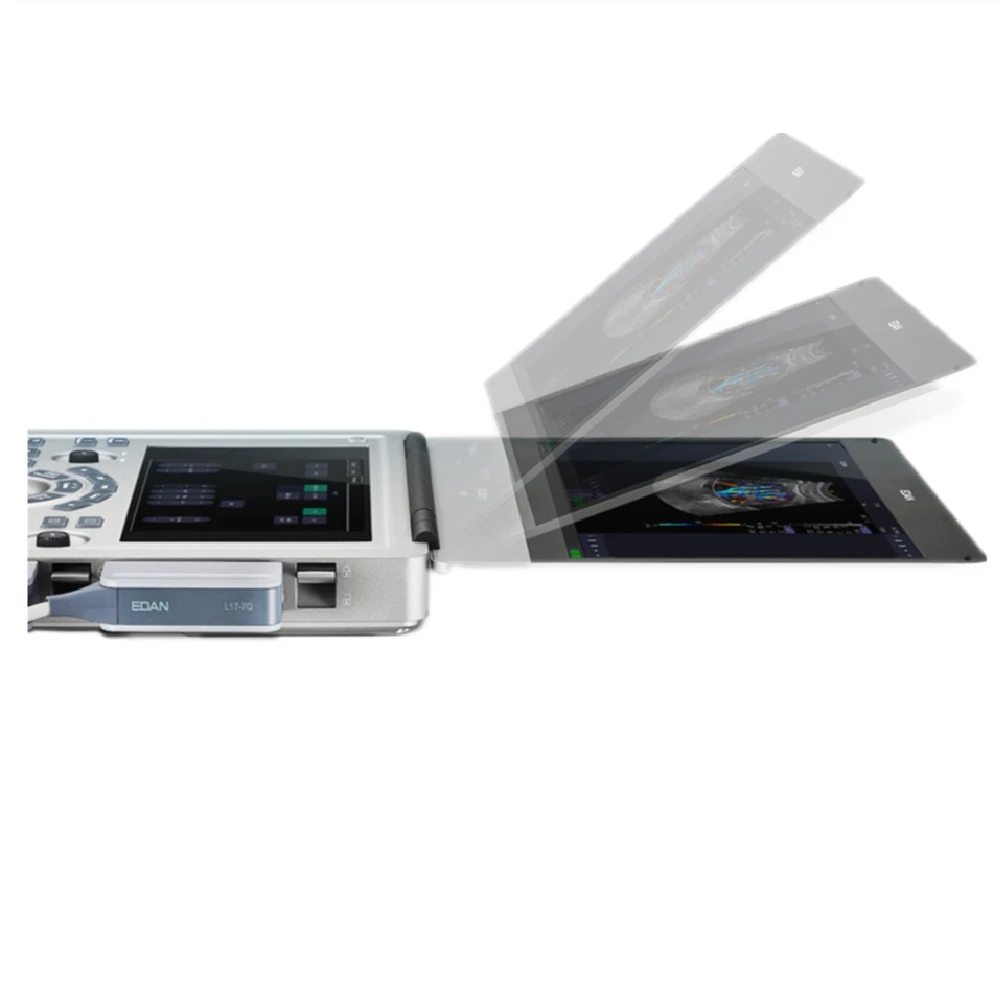 Edan AX2 Diagnostic Ultrasound System Color Doppler 2d Ultrasound