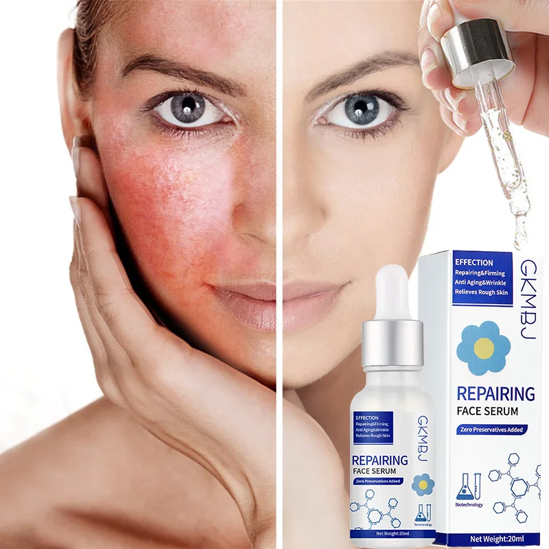microbial fermentation skin care 0 preservative,pore shrinking rough skin removal,surgery swelling collagen repairing face serum