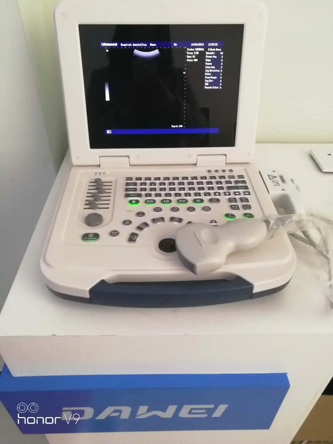 DW-580 low price portable ultrasound scanner & medical equipment