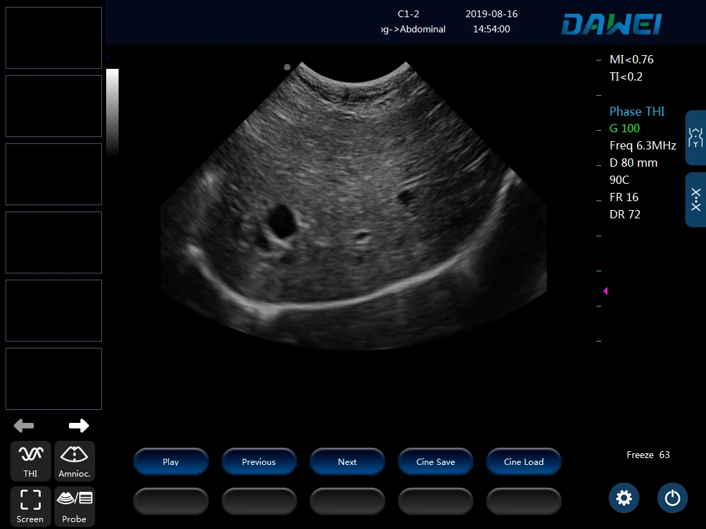 Pc Platform Full Digital Veterinary Black And White Ultrasound Diagnostic System