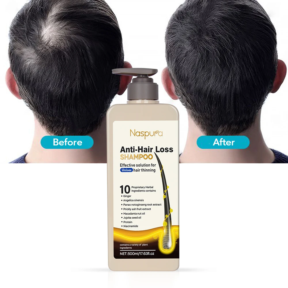 Thailand Wholesale Natural Ginger Shampoo Hair Regrowth Active Ingredients Hair Shampoo