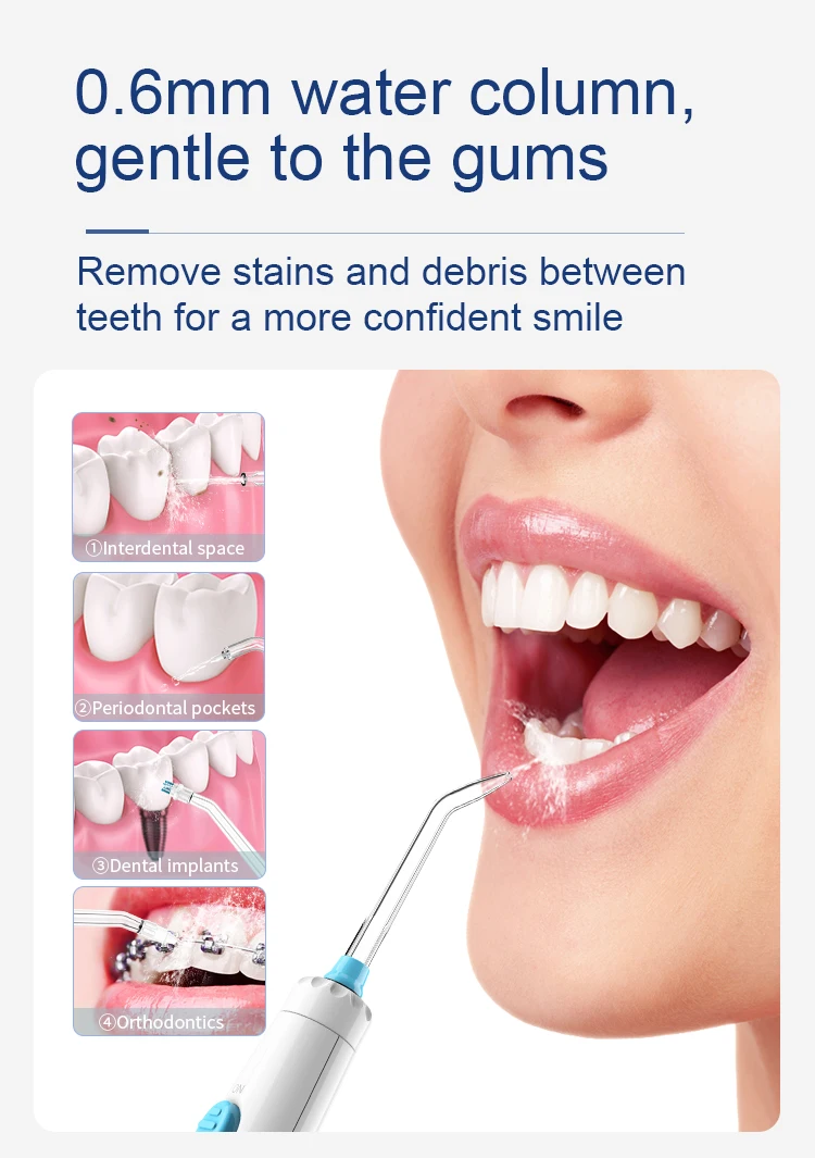 oral_irrigator (5)