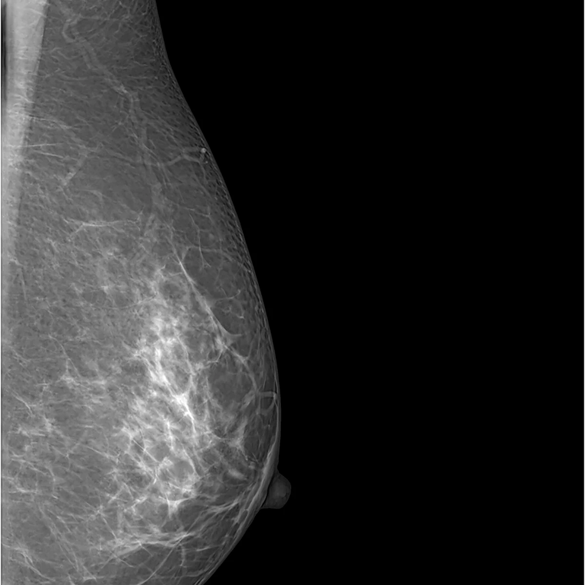 Careview 750M mammography flat panel detector price