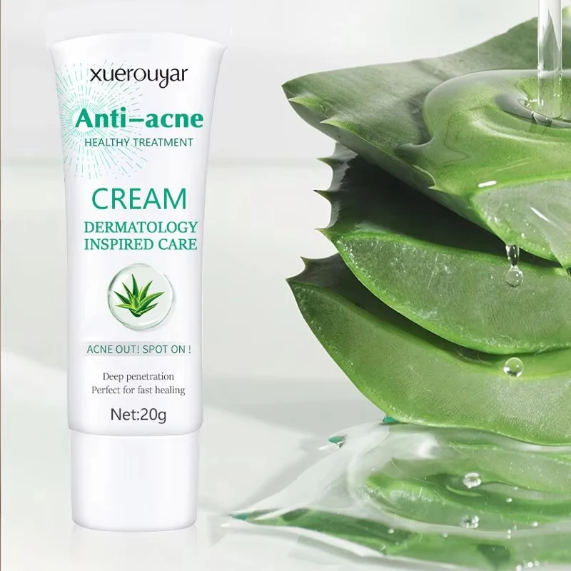 Skin Care Repair Pimples Acne Smooth Skin Shrink Pores Skin Moisturizer Gentle Anti Acne Whitening Aloe Vera Acne Face Cream