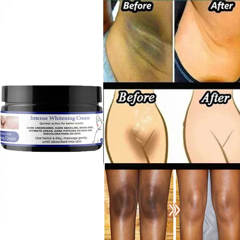 Intense Whitening Cream Private Label OEM Dark Spots Eraser Spotless Skin Underarm Bikini Inner Thigh Lightening Cream