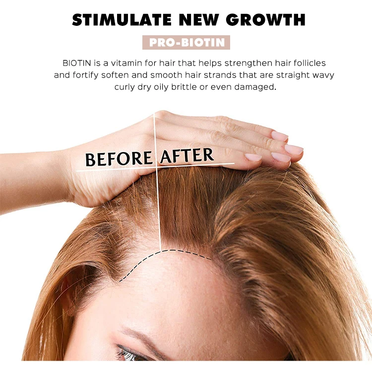 New Arrived Biotin Hair Shampoo Conditioner Stimulate Natrual Hair Regrowth Deep Intense Moisturizing for Thining Hair