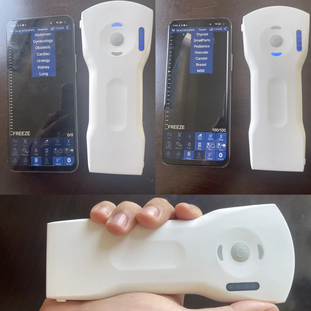 Wireless Medical Ultrasound Probe Portable And Convenient For Diagnostic Imaging