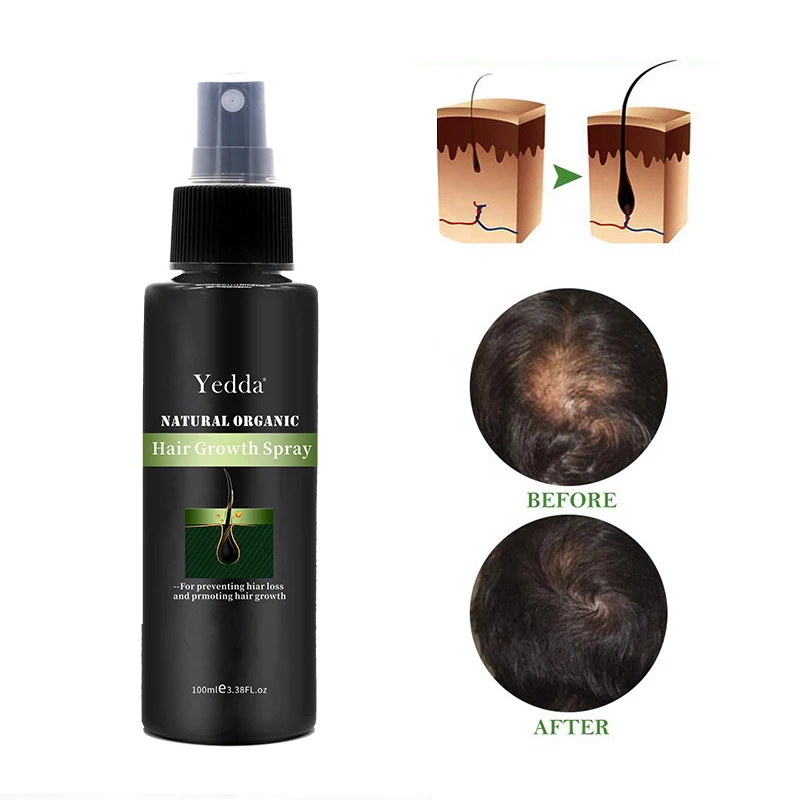Ginseng Extract Anti-hair Loss Hair Regrowth Spray Private Label Plant Extract Shampoo