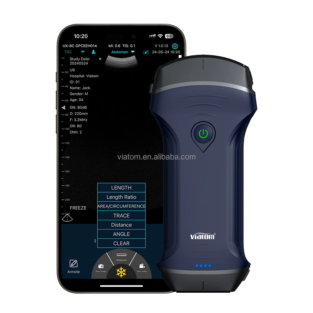 Viatom Wireless Ultrasound Scanner Portable Cooling Coating Technology Convex Cardiac Linear Medical Handheld Ultrasound Probe
