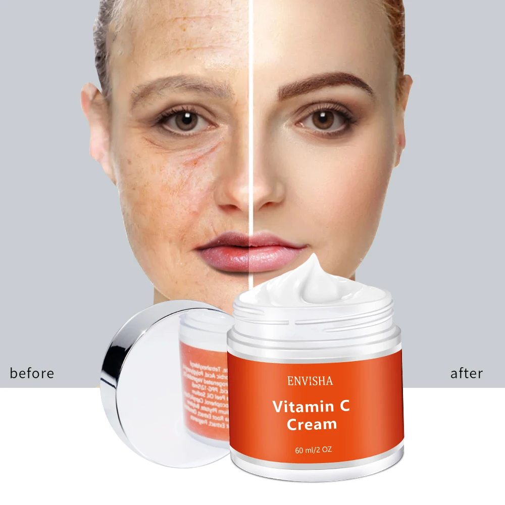 Wholesale Organic Vitamin C Face Cream Brightening Facial Dark Spot Freckle Removal Cream