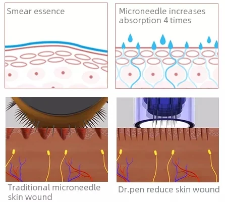 Dr. Pen M8 6 Speeds Electric 11/16/24/36/42 Pins Ultima Derma Pen Anti Aging MTS Microneedle Derma Needle Pen