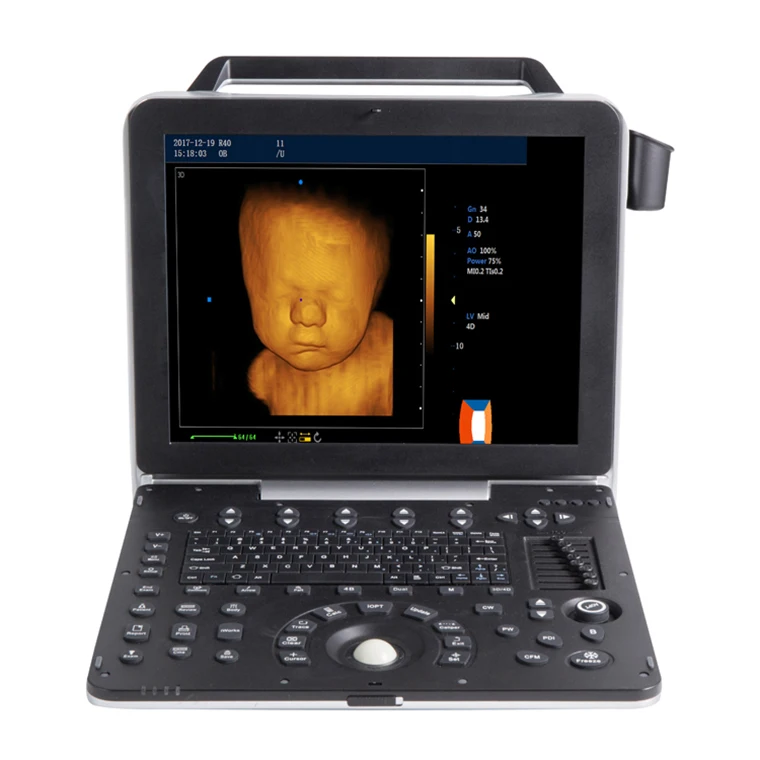 Ультразвуковая машина для ноутбука siui, ультразвуковая машина