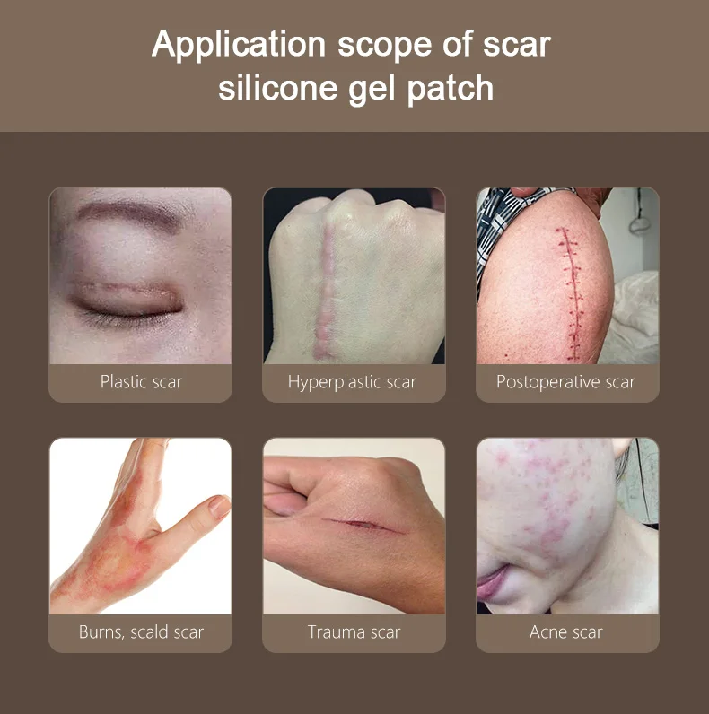 OEM Reusable Acne Tape Therapy Sheet Skin Repair Sheet Silicone Scar Removal Silica Gel Patch