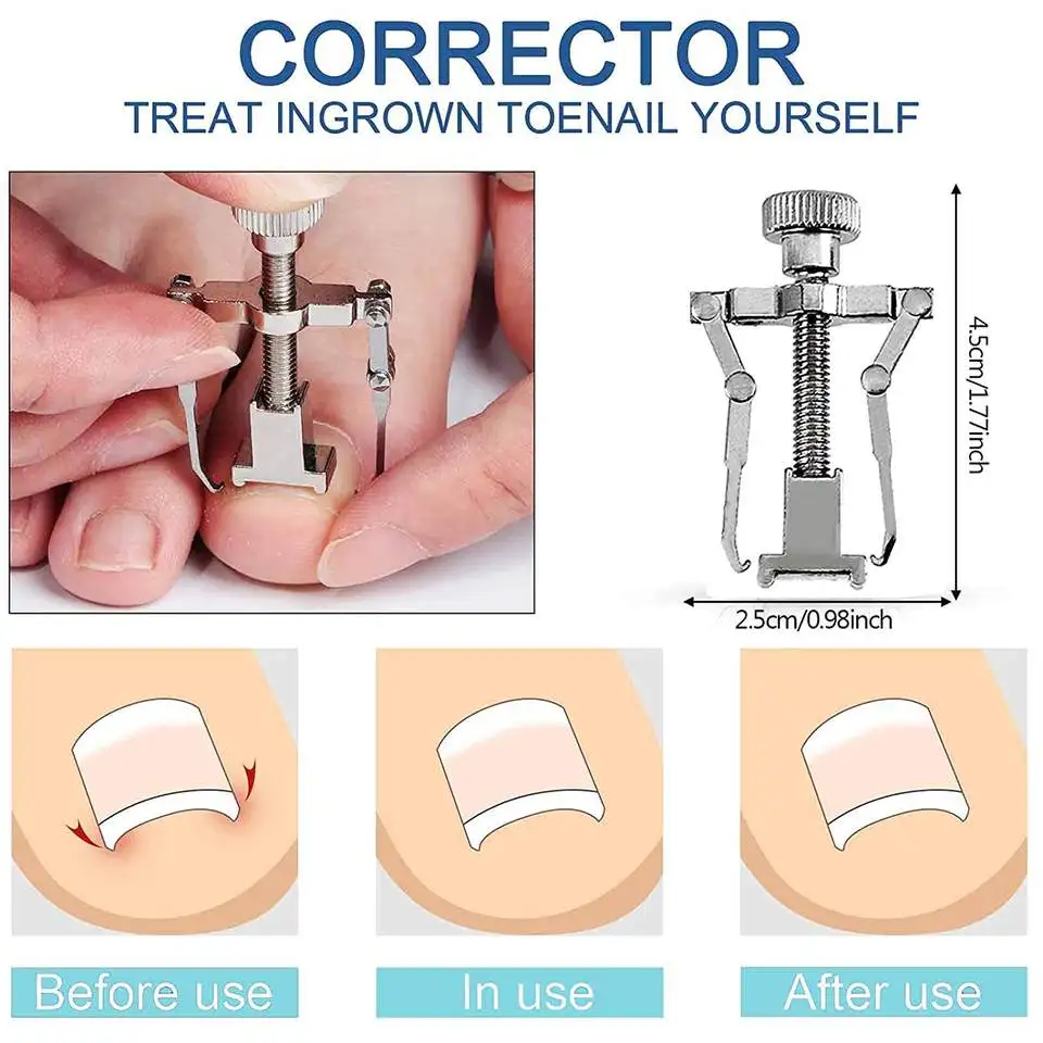 Новый тренд 7 предметов вросший маникюрный набор из нержавеющей стали для ногтей с корректором густых