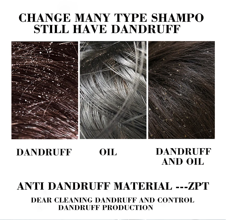 hair shampoo anti dandruff