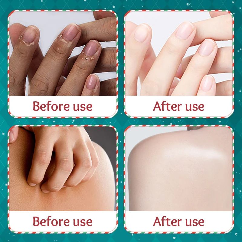 Private Label SADOER Christmas Gifts Set Nourish Anti-cracking Moisturizing Skin 5-Piece Set Natural hand Body Care Cream Lotion