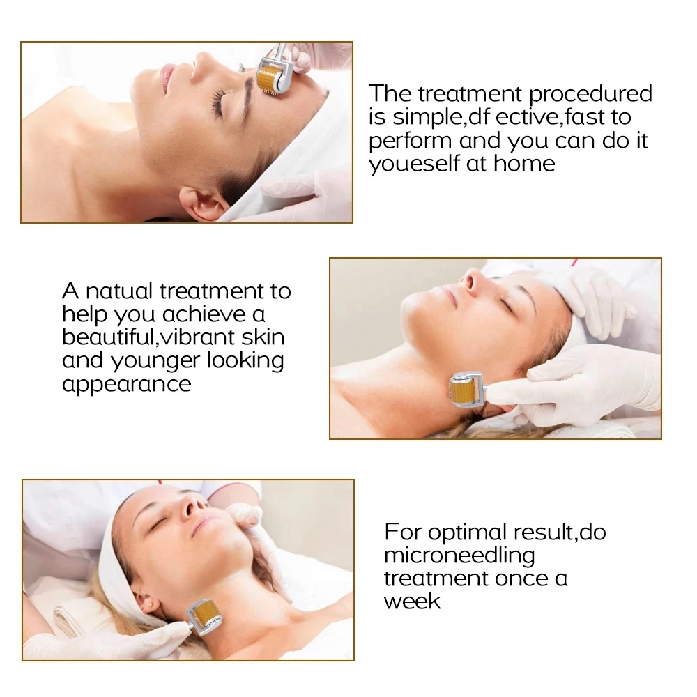 professional titanium micro needle derma roller, acne scars freckle skin cooling ice roller meso needle roller