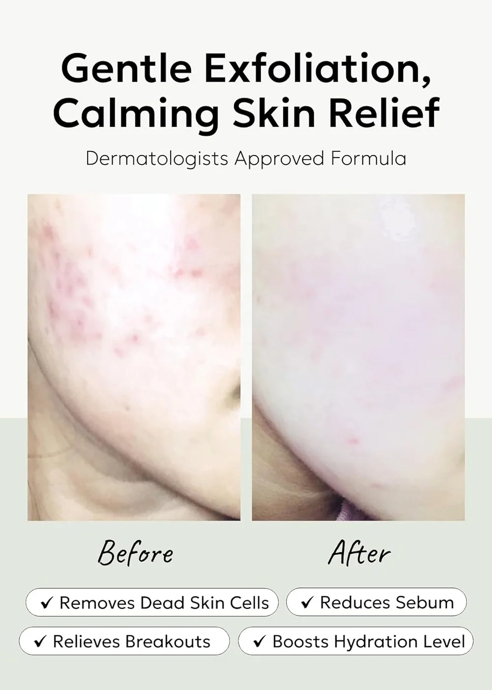 BHA Peeling Pad with Heartleaf Extract Facial Peels Hydrating  Exfoliating Toner Pads For Troubled Skin Breakouts