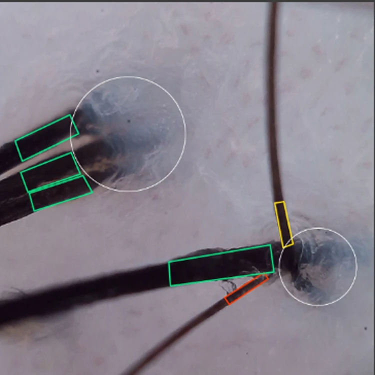 Skin Scalp Hair Tester Pen