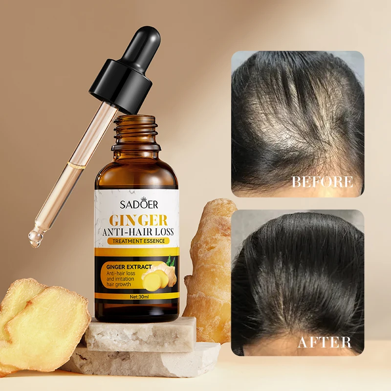 OEM SADOER private label best selling ginger anti-hair loss treatment hydrates repairs straightening hair care oil serum