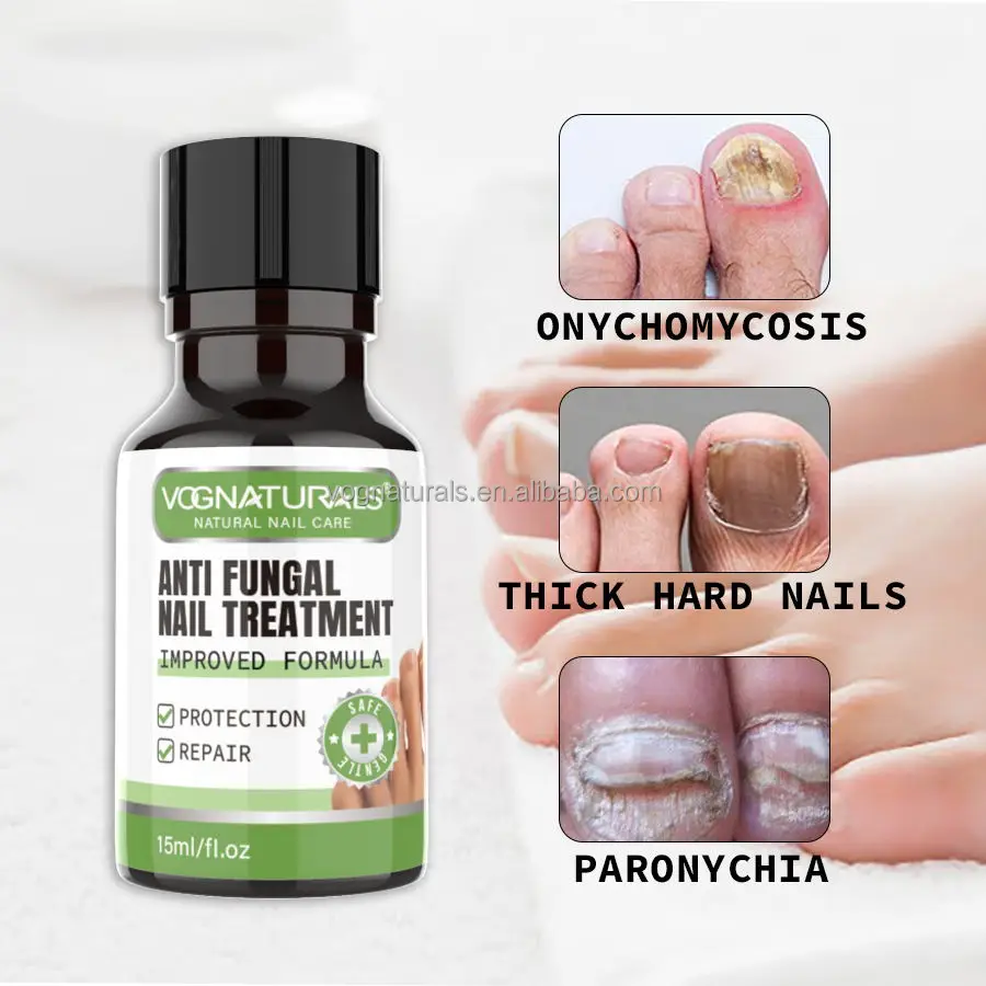 nail fungus 26
