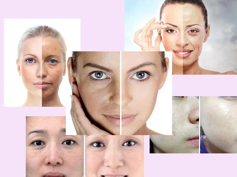 2 In 1 Hot And Cold Face Steamer For Salon Sauna Vapor Professional Vaporizer Facial Steamer 2 In 1 Hot Facial Steamer Cool