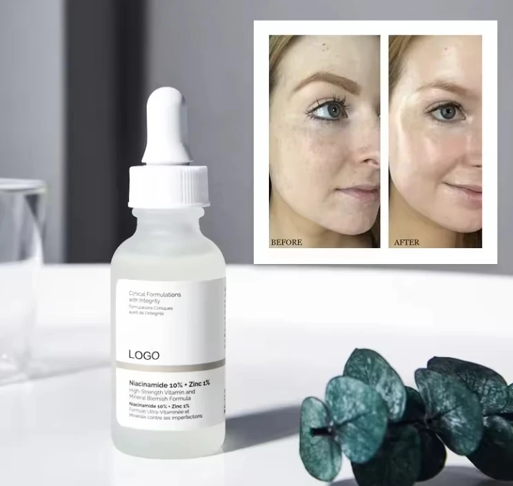 10% nicotinamide essence solution+1% zinc stay up late to brighten, shrink pores, control oil and fade spots