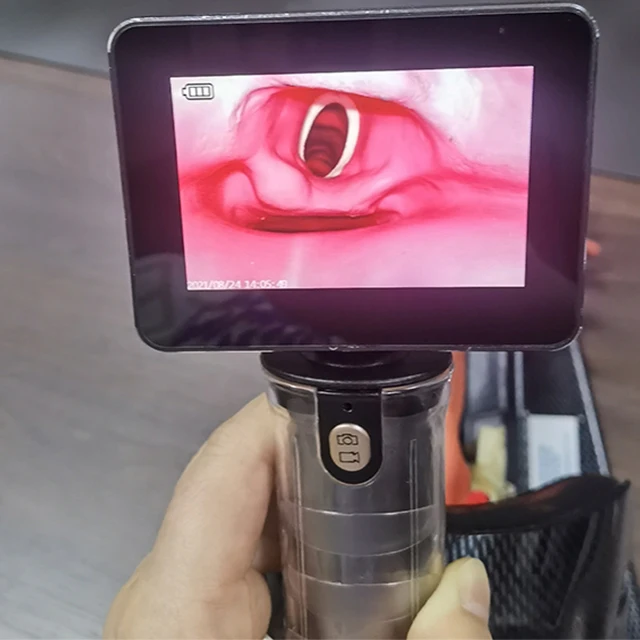 ANSHIDA Disposable Blade Rigid Intubation Video Laryngoscope Laryngoscopy Set with Camera