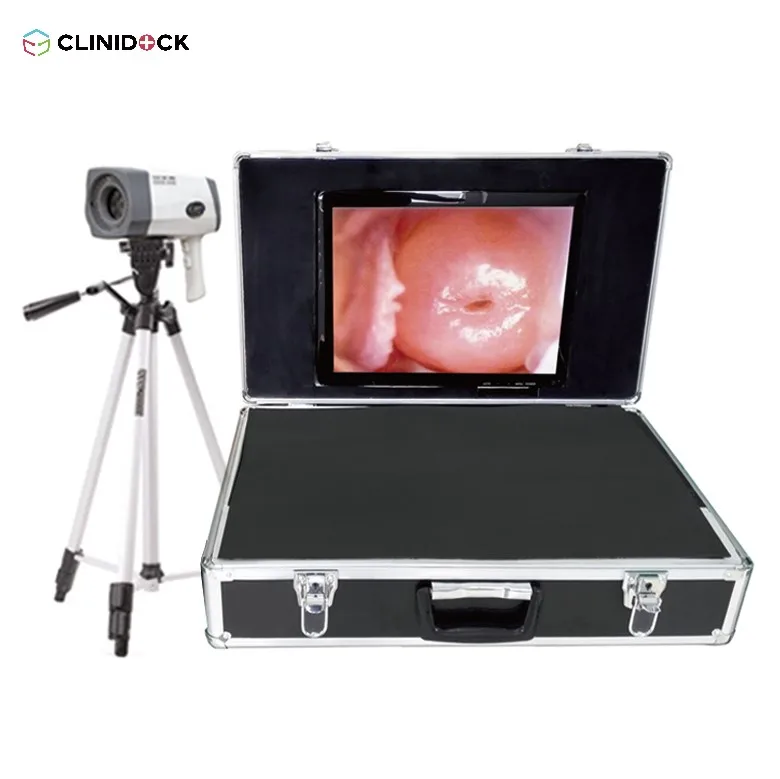 High end Portable Digital Electronic Colposcope, video colposcope for vagina CD-GJ-A8000A