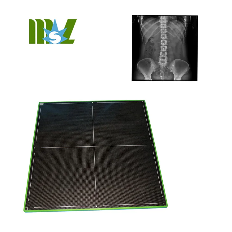 Digital Radiography 17*17 Digital Wireless X-ray Flat Panel Detector For DR System