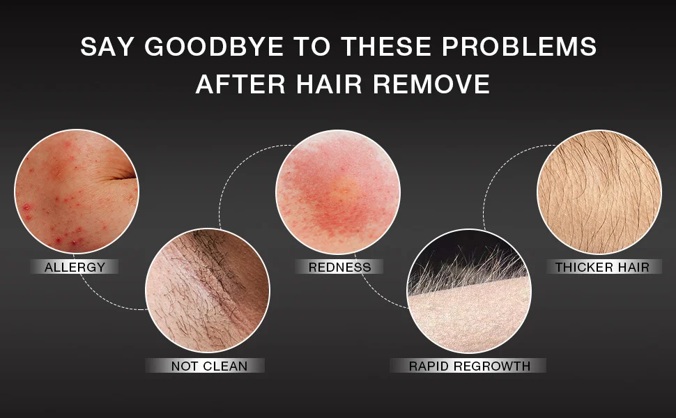 Крем для удаления волос мужчин натуральный безболезненный крем быстрое и эффективное средство с алоэ вера депиляционный