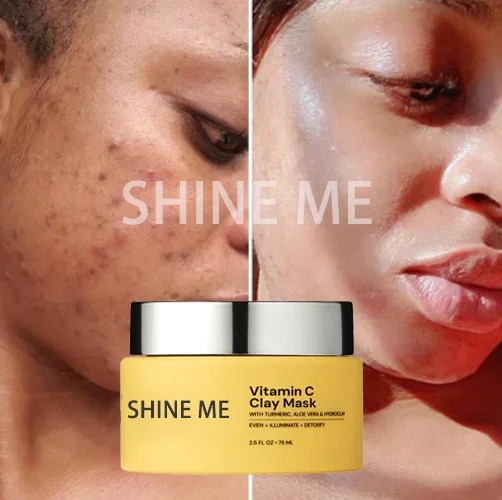 Whitening Vitamin C & Turmeric Clay Mask Brighten Facial Skin, Reduce Dark Spot, Anti-acne Refining Pores Improves Uneven Tone