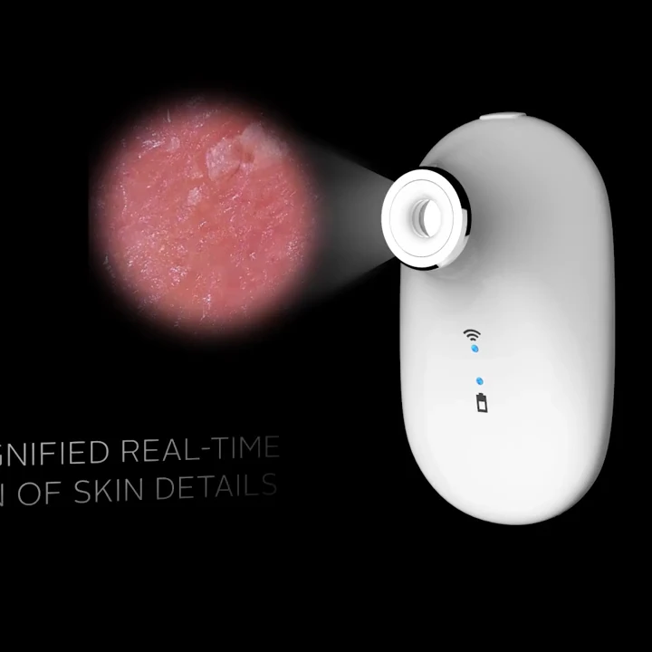 Portable diagnostic skin analyzer machine AI analyzer skin care AI skin problem analysis