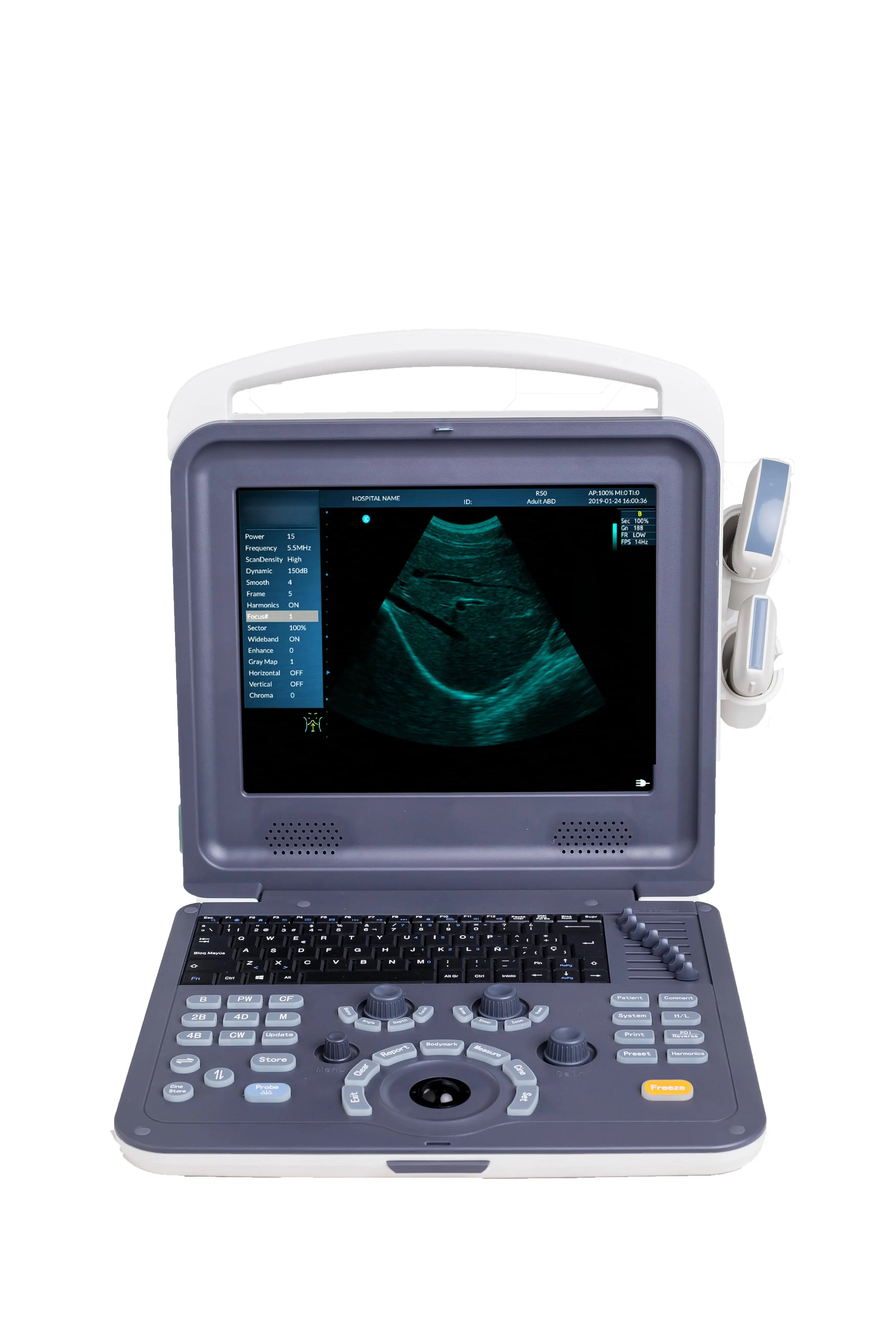 Amain Factory Wholesale Price Portable Ultrasound Color Doppler Ultrasound Scanner For Vet & Human