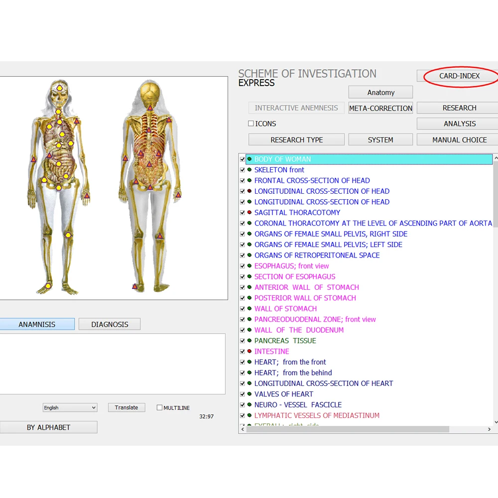 Russian Bioresonance Scanner Biochemical Analysis System,biochemical Analysis System 8d Lris Nls 8d Luis Nos Class II GY-518D CE
