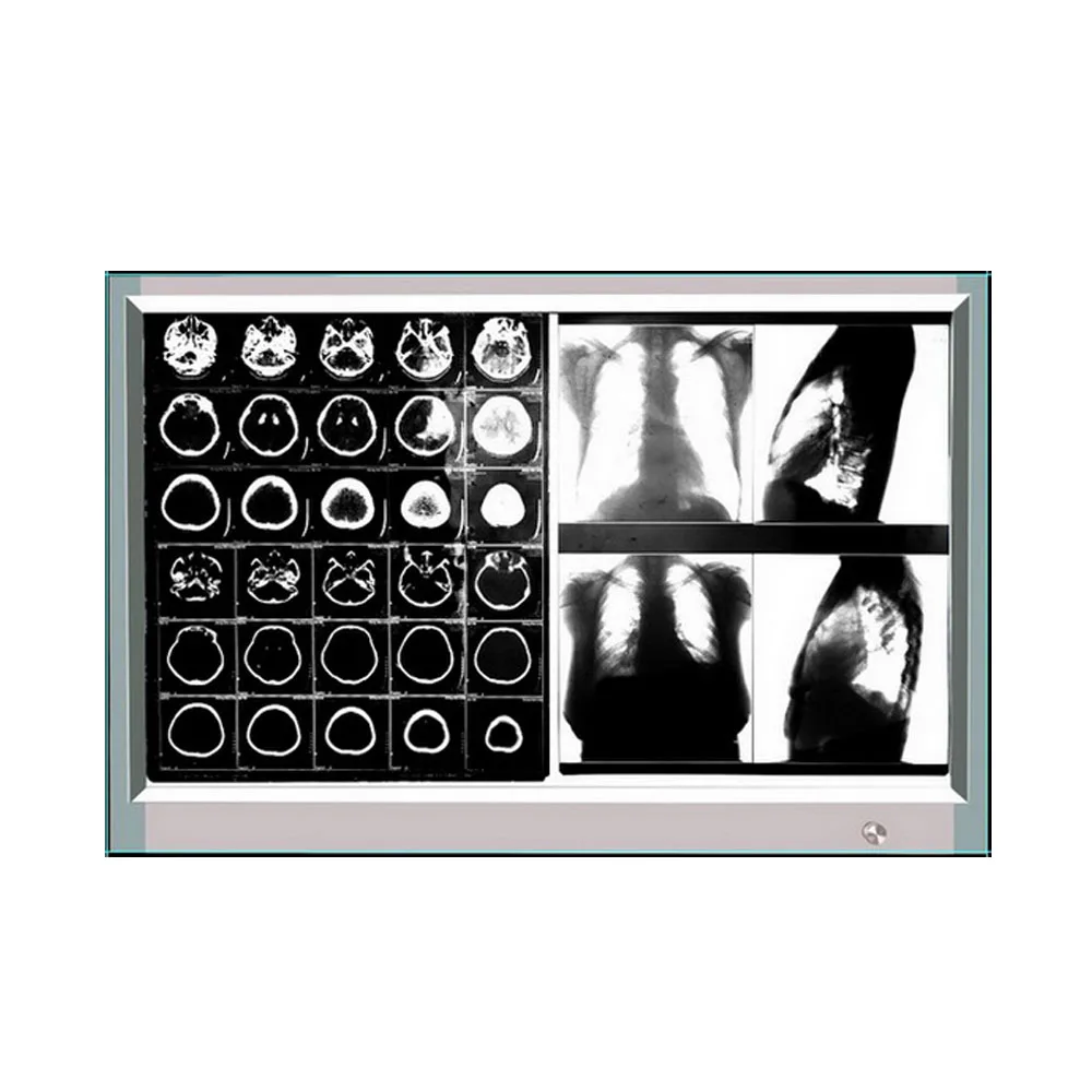 Двойная панельная медицинская светодиодная рентгеновская пленка GP1002A