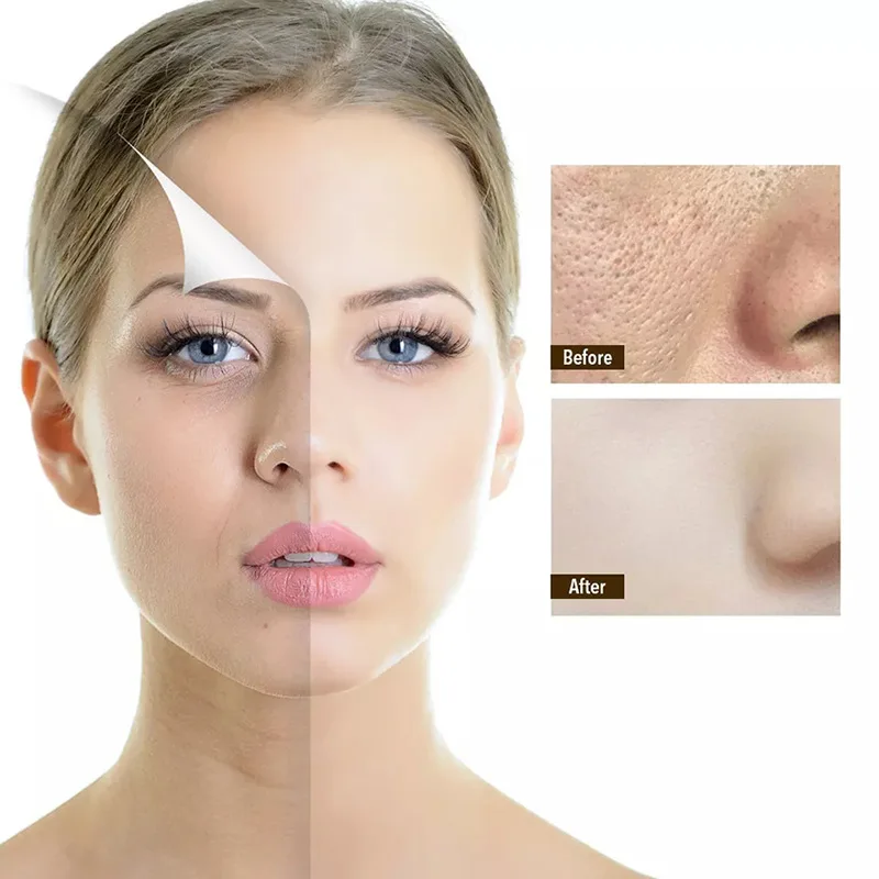 Rose Facial SerumAnti-aging  Face Essence Rose Gold Serum