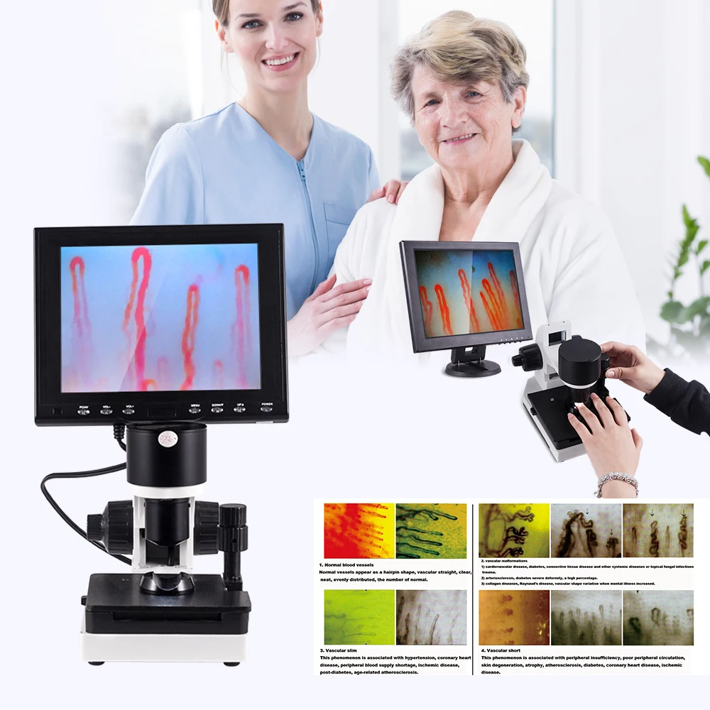 380000 Pixels 400 times nailfold Capillaroscopy Microcirculation Blood Capillary Microscope/Subhealth detector