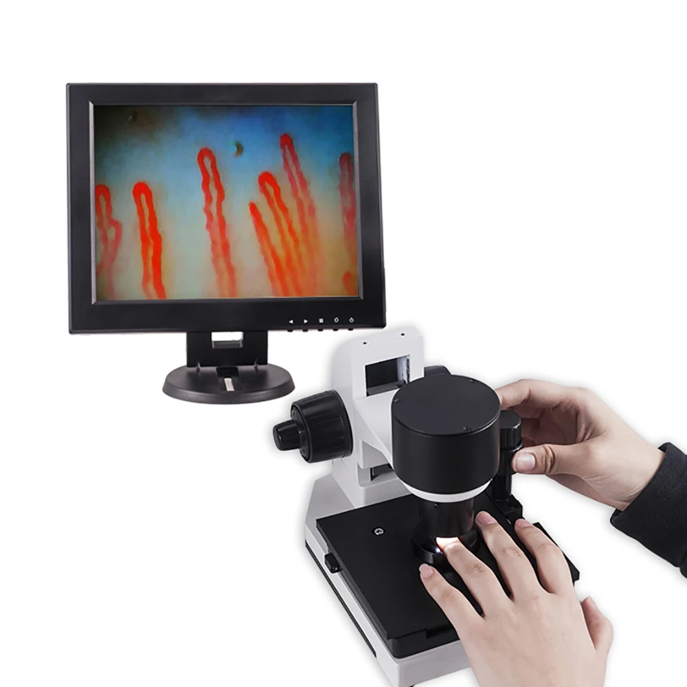 12 inch LCD blood circulation analysis clinical use analysis 680X Nailfold capillary microcirculation microscope