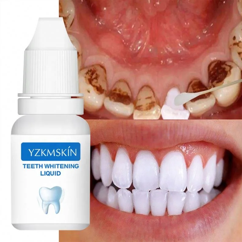 professional easy white teeth whitening essence liquid wholesale organic oral care solution teeth whiteners with cotton swab