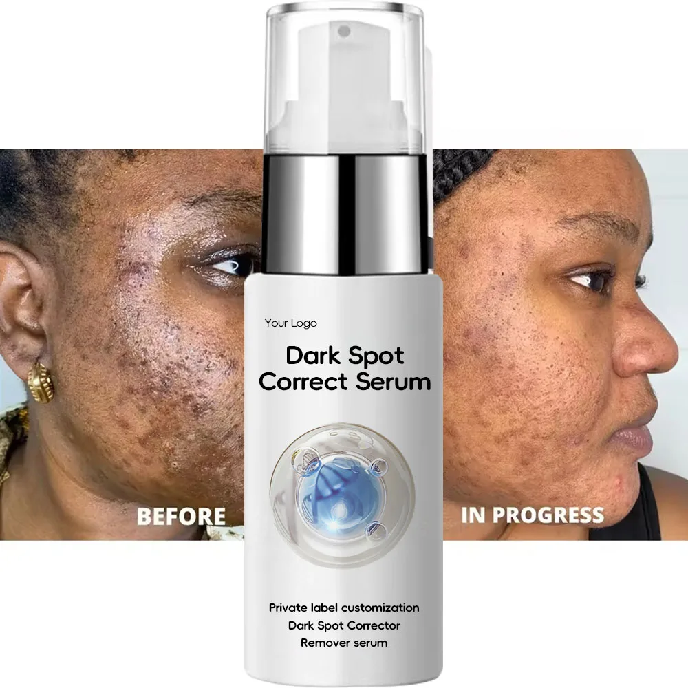 private label vitamin c whitening aloe vera Repairing kojic acid Corrector Dark Removal serum skin for brightening care