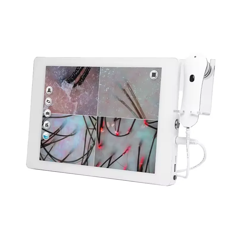 Face And Scalp Analyzer Skin Analyzer Portable Digital Scalp Hair Follicle Detector