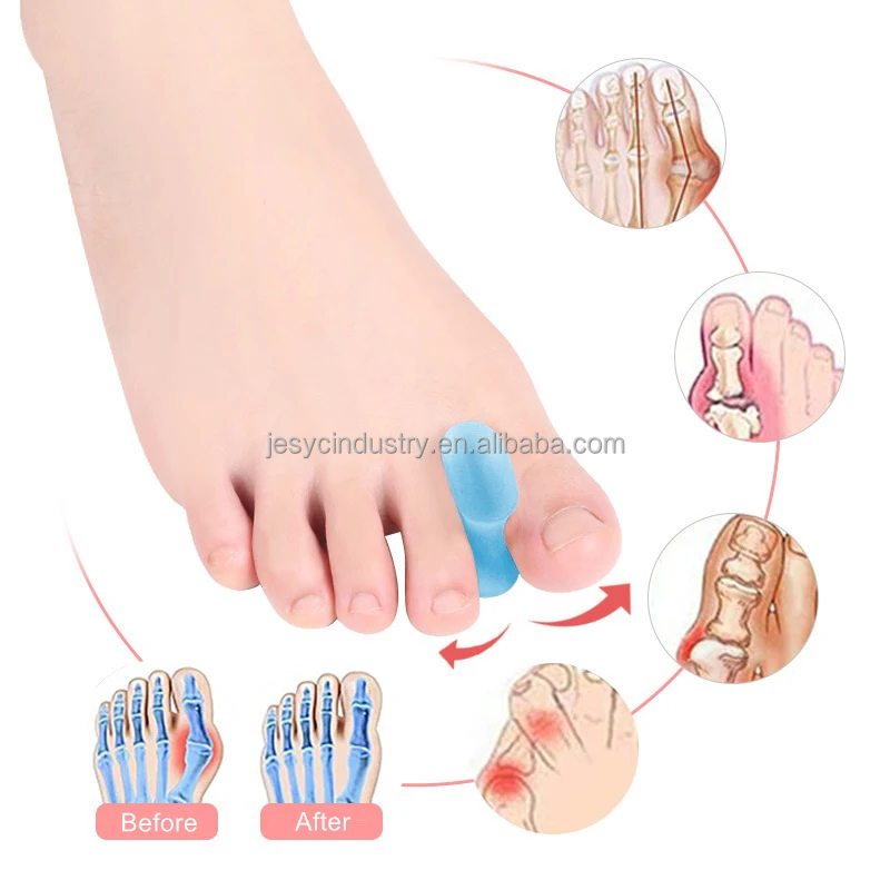 Silicone Big Toe Separator Hallux Valgus Bunion Corrector Brace Protector Toes Separator Silicone Gel Toe Spacer Corrector