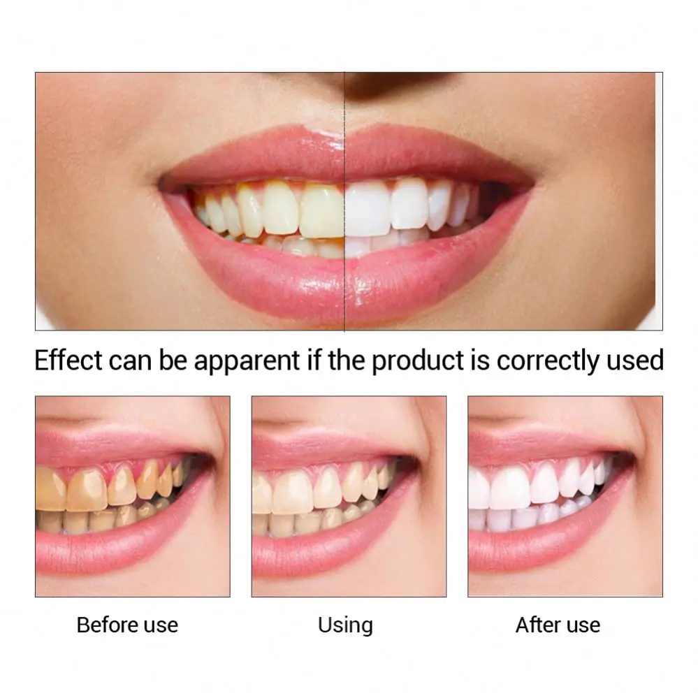 EFERO teeth whitening Powder kit Oral Hygiene product easy white teeth whitening teeth whitening serum essence liquid