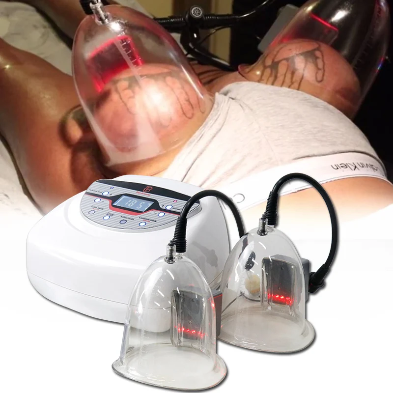 Starvac Sp2 M6 Vacuum Therapie Massage Body Cellulite Removal Chinese Cupping Therapy Lymphatic Drainage Massager Machine
