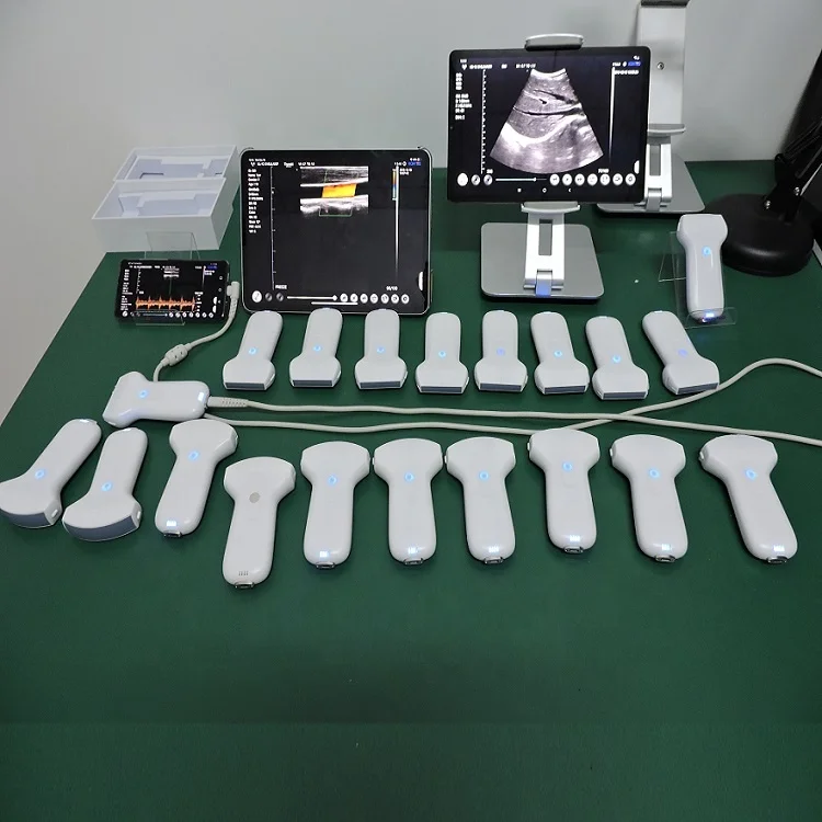 Medical Ultrasound Instruments Usg Portable Wireless Probe Electric Plastic Ce Color Doppler Ultrasound Price 256 Level Class II