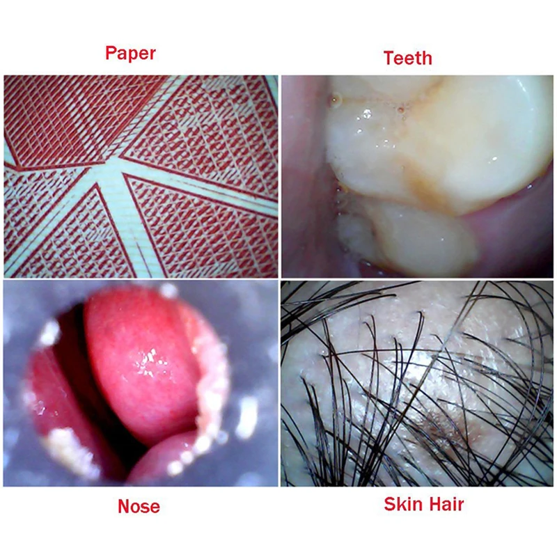 Medical USB Endoscope 4.9mm Lens for Ear Nose for OTG Android Phone PC Borescope Inspection Otoscope Endoscope Camera